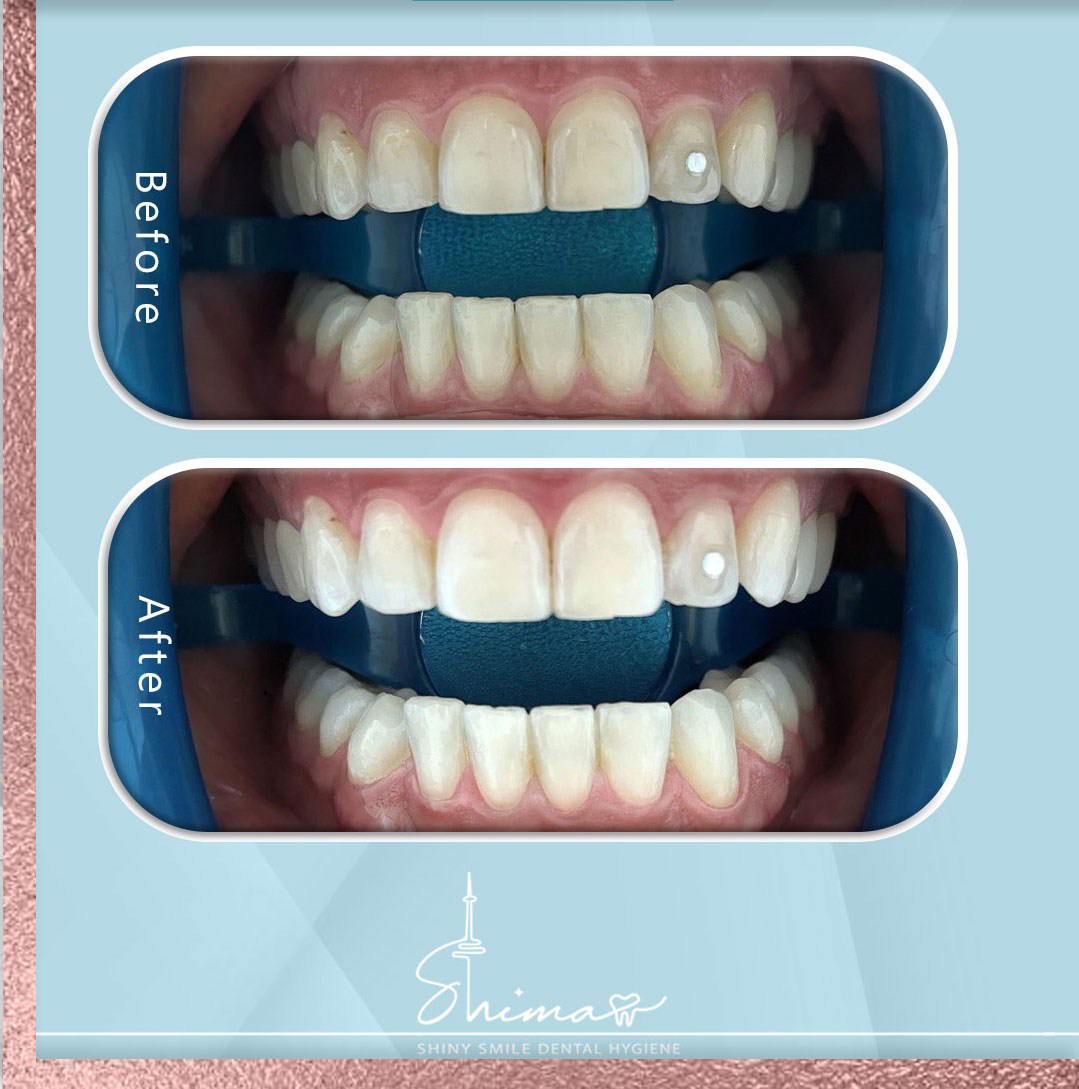 Description for gallery image 10