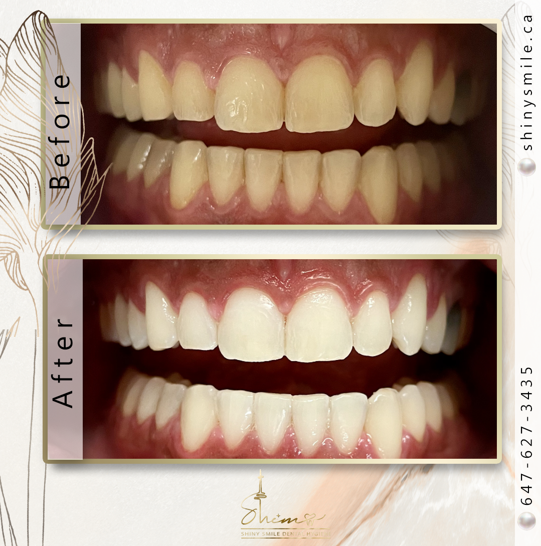 Description for gallery image 11