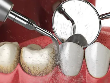 Description for gallery image 2