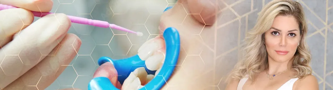 Description for gallery image 20