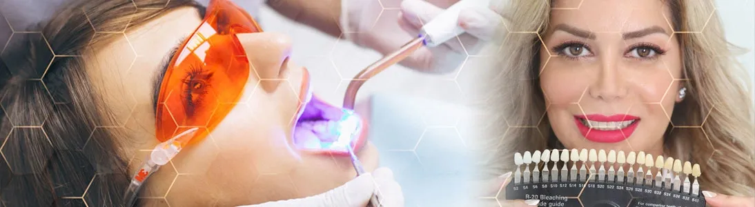 Description for gallery image 23