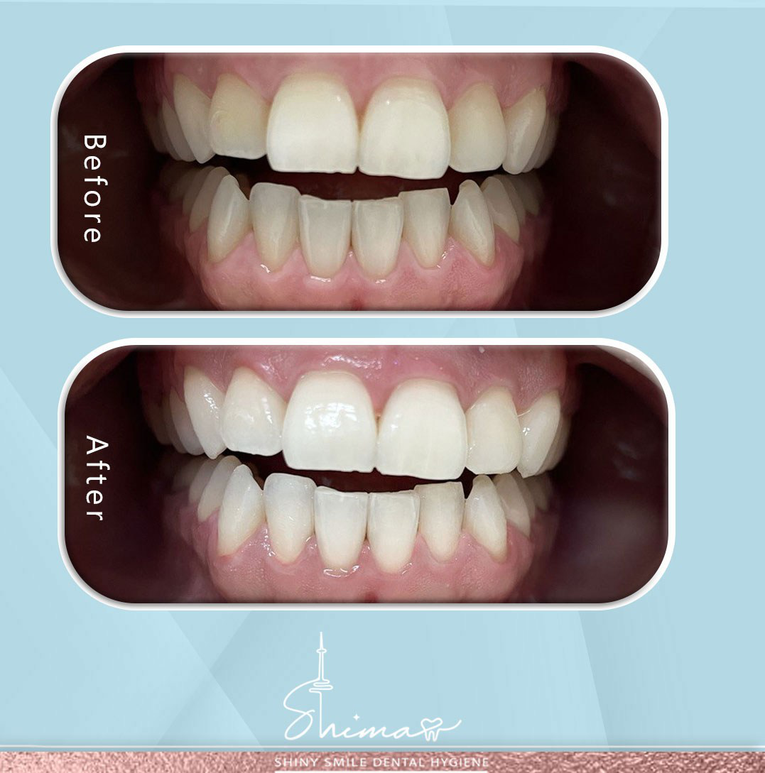 Description for gallery image 8