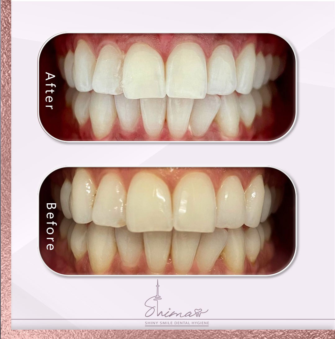 Description for gallery image 9